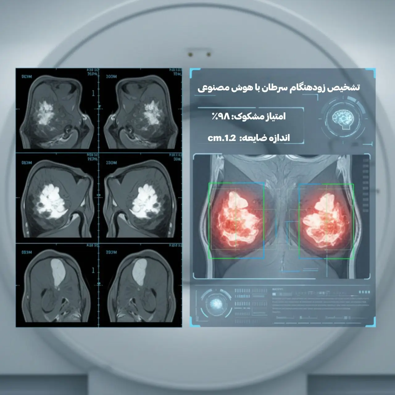 این تصویر نشان میدهد که چگونه الگوریتمهای هوش مصنوعی میتوانند ضایعات کوچک و پنهان در اسکنهای MRI را شناسایی کنند